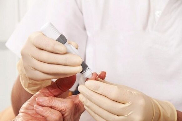 Diabetesa azukrea neurtzeko odol hesia