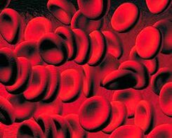 Diabetesan odolean dauden ketoneko gorputzak metatzea